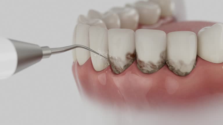Reliable Dental contractor in Woodworth, OH by Dentist Open Now